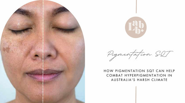 Pigmentation SQT for Hyperpigmentation