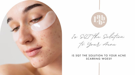 SQT for Acne Scarring - A Solution to Your Woes