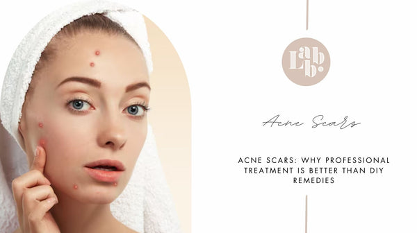 Professional Treatment for Acne Scars